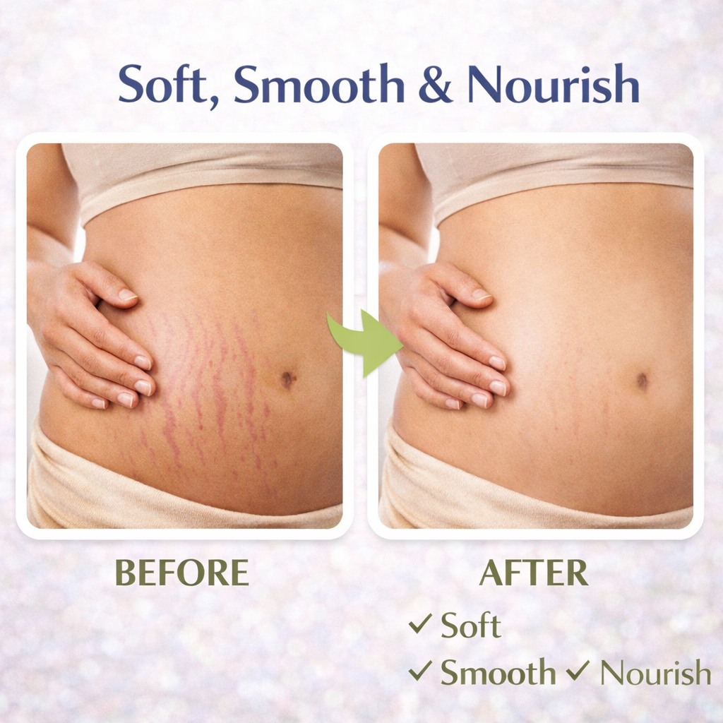 Stretch Marks & Scar oil