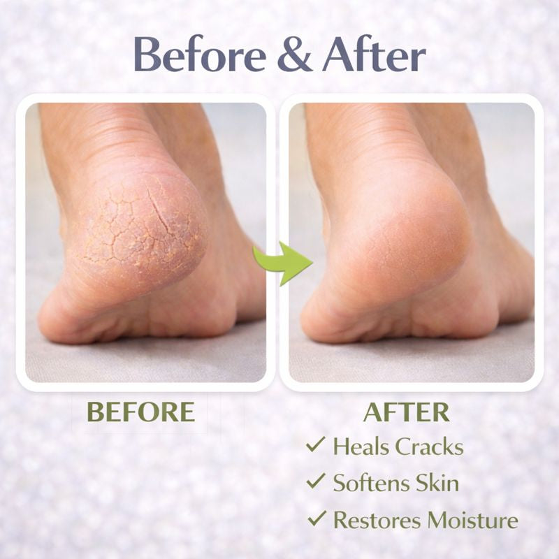 Foot & Heel Repair